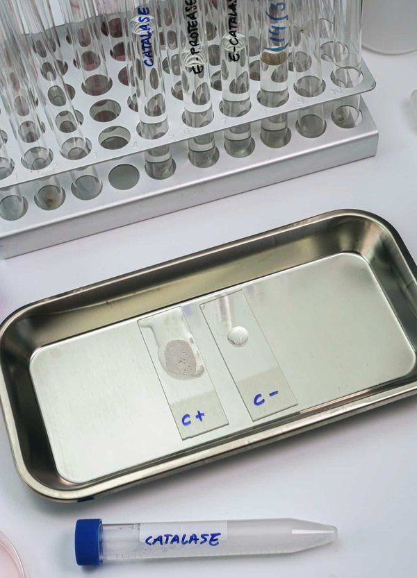 Can the Use of Digestive Enzyme Supplements Improve Gut Health?